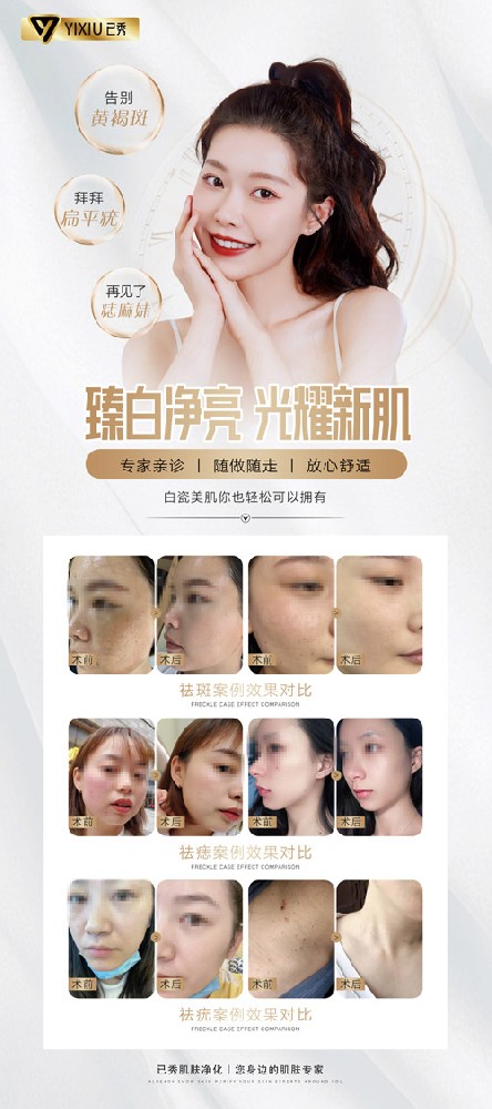 怎么合作已秀瘦身